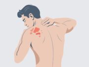 Epidermolysis bullosa: FDA-Zulassung für gentechnisch veränderte Hauttransplantate