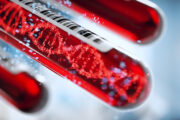 ASCO 2025: Kein Erfolg mit neoadjuvanter Therapie bei aggressivem Prostatakrebs - aber interessanter Nebenbefund