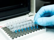 Melanom: Adenosinphosphat-Signalgebung prognostiziert Immuntherapie-Ansprechen