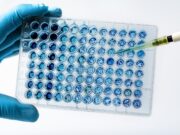 Melanom: Studie zeigt Nutzen molekularer Tumoranalyse