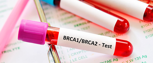 BRCA1/2-Keimbahntestung 