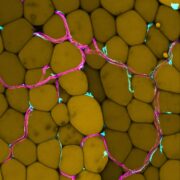 Wie Fettgewebe unsere Blutgefäße verändert: Neue Erkenntnisse zur Gefäßgesundheit bei Übergewicht