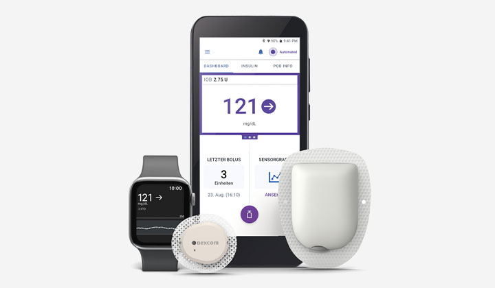 © Dexcom/Insulet
