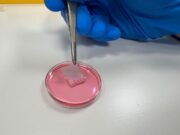 Tissue Bioengineering: Nanofaser-Transplantat für Brandwunden entwickelt