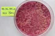Auf Bakterienfang, um gegen Antibiotikaresistenzen zu kämpfen