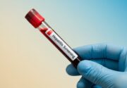 DGVS sieht im Screening auf Hepatitis B und C ein „Erfolgsmodell“