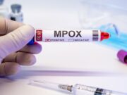 Viruslast-Test zur Prognose des Mpox-Schweregrads bei Auftreten erster Hautläsionen