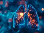 Lungenkrebs bei Nichtrauchern: Luftverschmutzung kann laut neuer Studie dazu beitragen