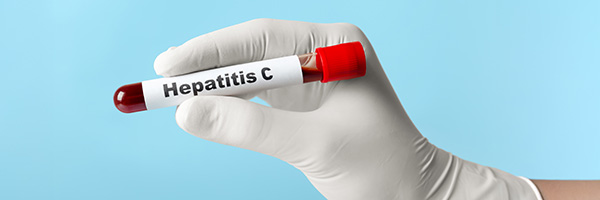 Hepatitis C Headerbild 600x200