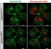 Netzhauterkrankungen: Protein ADAM10 spielt entscheidende Rolle
