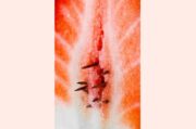 Vulvodynie: Eine Krankheit, über die gesprochen werden muss