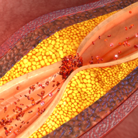 iStock-610988158_Kardiologie_200x200px