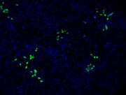 Hepatitis E-Virus kann auch Nierenzellen befallen