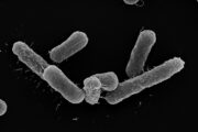 Multiresistente Darmbakterien: Verdrängung durch Nahrungskonkurrenz