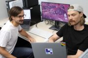 Darmkrebs: KI-Modell erkennt in Gewebeproben mehrere genetische Merkmale gleichzeitig