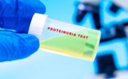 Nephrotisches Syndrom: Erhöhte CDC42-Aktivität kann zu Proteinurie führen