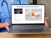 Die optimale Dosis von Methylprednisolon zur Behandlung der schweren Mycoplasma-pneumoniae-Pneumonie