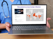 Die optimale Dosis von Methylprednisolon zur Behandlung der schweren Mycoplasma-pneumoniae-Pneumonie