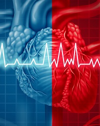Atrial Fibrillation