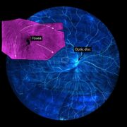 Visuelle Wahrnehmung: Auf das Timing kommt es an