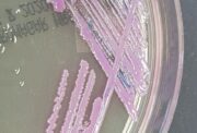 One Health: Antibiotika-Resistenzen gefährden Mensch und Tier