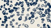 Prostatakrebszellen: Wichtige Merkmale für Therapieansprechen sowie Resistenz identifiziert