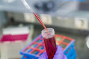 Bauchspeicheldrüsenkrebs: Neues nicht invasives Diagnostikverfahren entwickelt