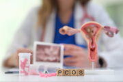 PCOS: Bestimmte Genvarianten mit erhöhter Testosteronproduktion assoziiert