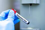 Kaliumspiegel selbst messen: Forscher arbeiten an minimalinvasiver Lösung für zu Hause