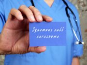 Plattenepithelkarzinom: Äquivalente Ergebnisse bei Beurteilung durch KI und Dermatologen