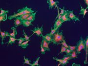 Vielfalt von Fibroblasten könnte neue Behandlungswege ermöglichen