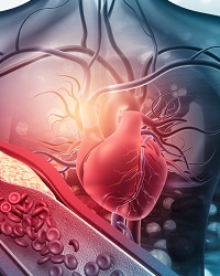 Human heart with blocked arteries