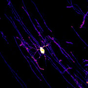 Erythropoietin verbessert Kognition – Studie zeigt therapeutisches Potenzial