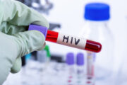 HIV: Neu identifizierter Antikörper könnte die Behandlung verbessern