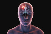Neue Therapie gegen aktive Hirnmetastasen