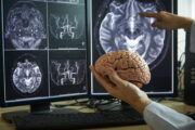 Hirnscan als BMI-Orakel für psychisch kranke Menschen