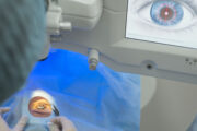 Laserkorrektur bei Myopie: Studie belegt Wirksamkeit und Sicherheit bei Teenagern
