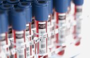 Diagnose der Krebstherapie-bedingten Myokarditis: Flüssigbiopsie auf Basis zellfreier mRNA