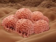 Neue Angriffspunkte des Immunsystems auf Melanomzellen identifiziert