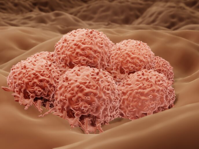 Melanomzellen auf der Haut