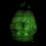Alzheimer bei Mäusen mithilfe von Nanopartikeln geheilt