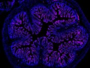 Abdominale Schmerzen aufgrund von Darmerkrankungen: Neue Erkenntnisse bergen vielversprechende Therapieoptionen