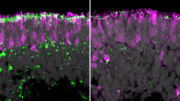 Ansatz für neue Gentherapie: Humane Organoide und Retina-on-Chip-Modell
