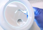 Neuartiger Stent soll Thromboserisiko reduzieren