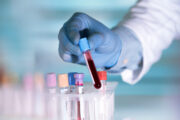 Genetische Blutanalyse zur Früherkennung von Parkinson