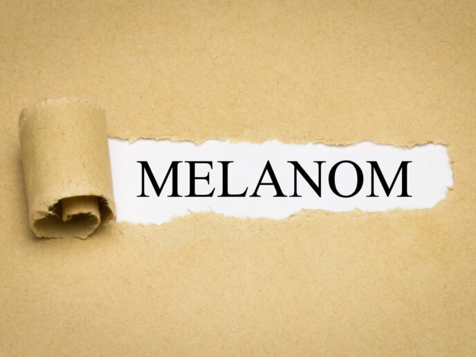 Melanom