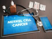 Immuntherapie reduziert Rezidivrisiko beim Merkelzellkarzinom