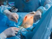 Allergische Erkrankungen erhöhen Risiko postoperativer Komplikationen