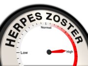 Zytokine korrelieren bei Herpes zoster mit Schmerzintensität
