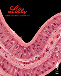 LILLY_R_2025_009_Omvoh_Banner_Darmzotten_200x250
